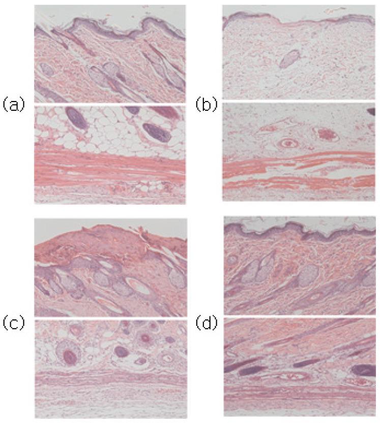 https://cdn.ncbi.nlm.nih.gov/pmc/blobs/b0d0/10099235/1732a08aae93/sensors-23-03620-g010.jpg
