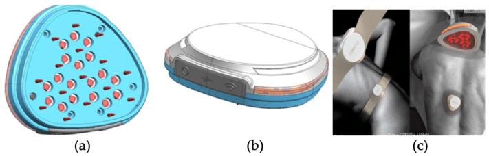https://cdn.ncbi.nlm.nih.gov/pmc/blobs/b0d0/10099235/6a362ab81905/sensors-23-03620-g001.jpg