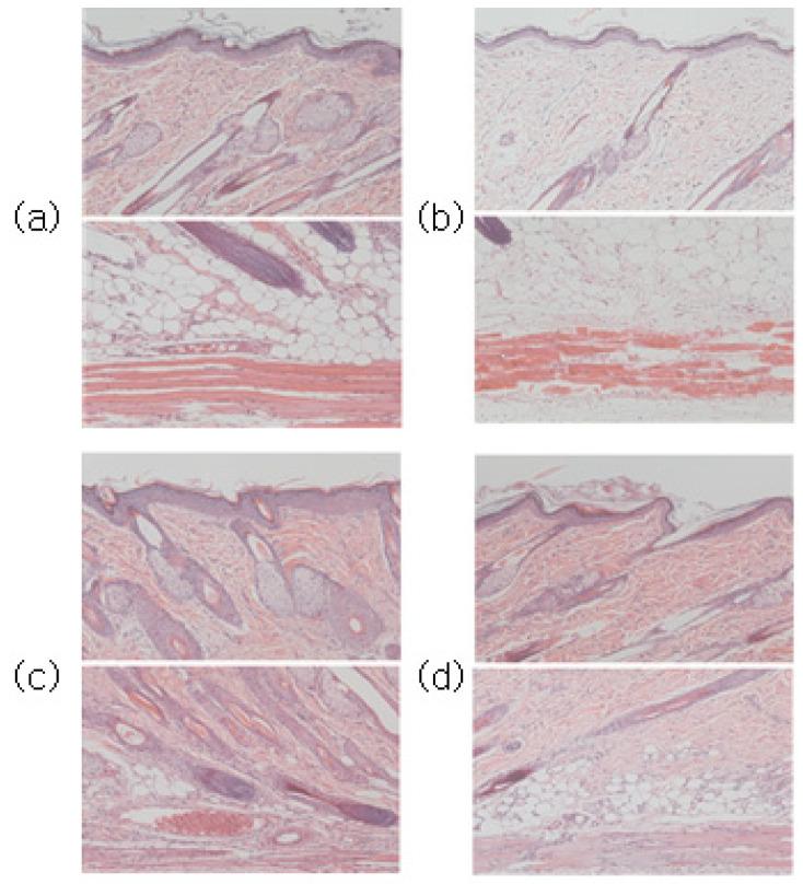 https://cdn.ncbi.nlm.nih.gov/pmc/blobs/b0d0/10099235/7d60b0679949/sensors-23-03620-g009.jpg