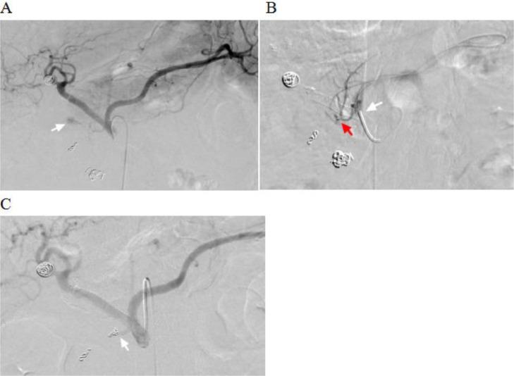 https://cdn.ncbi.nlm.nih.gov/pmc/blobs/b0d8/11381971/7a6a9d4bde81/gr4.jpg