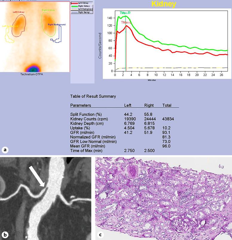 https://cdn.ncbi.nlm.nih.gov/pmc/blobs/b0db/11309751/504d956d8ecd/cnd-2024-0014-0001-539772_F01.jpg