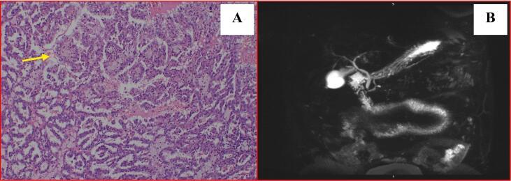https://cdn.ncbi.nlm.nih.gov/pmc/blobs/b0dc/10382848/089daf0dac46/gr2.jpg