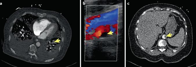 https://cdn.ncbi.nlm.nih.gov/pmc/blobs/b0e1/7675396/32c9c50647ec/41569_2020_469_Fig2_HTML.jpg