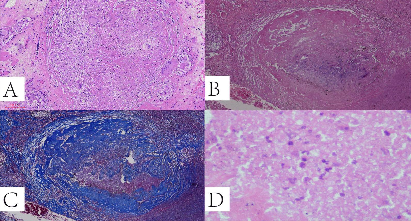 https://cdn.ncbi.nlm.nih.gov/pmc/blobs/b0e7/8981736/ffeb6157565c/12890_2022_1910_Fig5_HTML.jpg