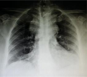 https://cdn.ncbi.nlm.nih.gov/pmc/blobs/b0ec/4147647/2d9235fc6c53/gr1.jpg