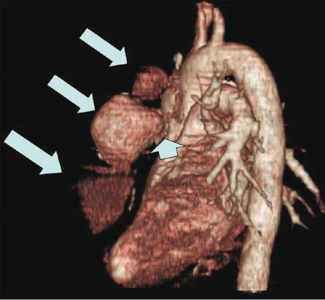 https://cdn.ncbi.nlm.nih.gov/pmc/blobs/b0ee/3180985/15cefed8e699/APC-4-195-g002.jpg