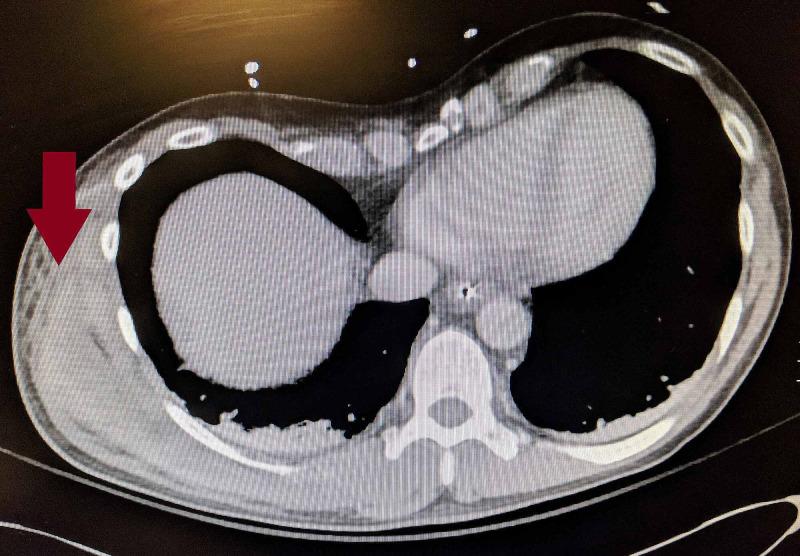 https://cdn.ncbi.nlm.nih.gov/pmc/blobs/b0ef/7781785/0c2a15608ec2/cureus-0012-00000011880-i01.jpg