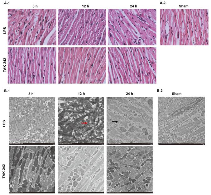 https://cdn.ncbi.nlm.nih.gov/pmc/blobs/b0f2/7974310/94bf01402c3f/mmr-23-05-11973-g02.jpg