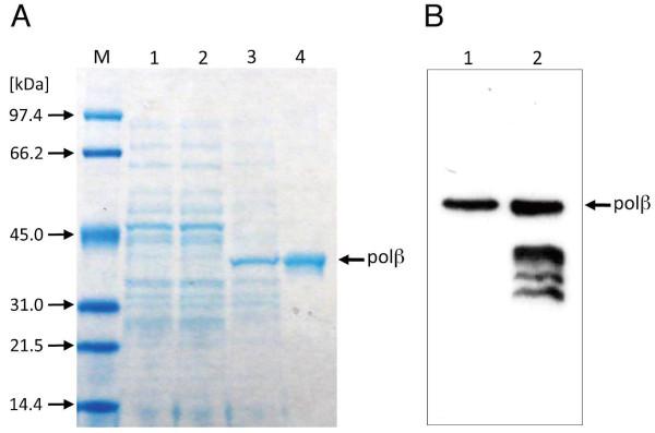 https://cdn.ncbi.nlm.nih.gov/pmc/blobs/b0f3/3214136/0a0f0104788d/1475-2859-10-84-3.jpg