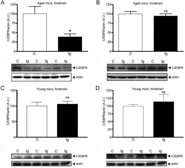 https://cdn.ncbi.nlm.nih.gov/pmc/blobs/b0fd/3096570/75c3c549eaed/1742-2094-8-34-4.jpg