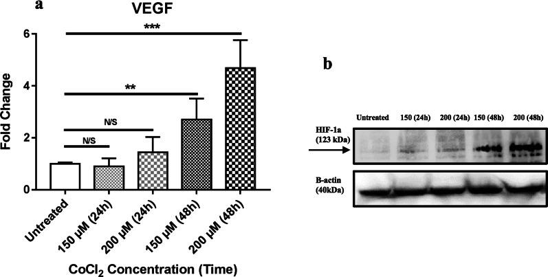 https://cdn.ncbi.nlm.nih.gov/pmc/blobs/b102/7275393/b6033e4cedcd/40659_2020_293_Fig3_HTML.jpg