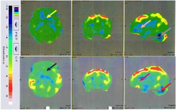 https://cdn.ncbi.nlm.nih.gov/pmc/blobs/b106/5793399/155301750900/13287_2017_748_Fig7_HTML.jpg