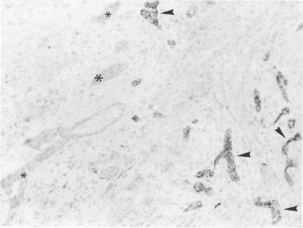 https://cdn.ncbi.nlm.nih.gov/pmc/blobs/b10b/1886895/1871d9ba4b86/amjpathol00077-0165-b.jpg