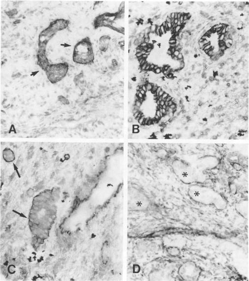 https://cdn.ncbi.nlm.nih.gov/pmc/blobs/b10b/1886895/2d59a9028298/amjpathol00077-0163-a.jpg