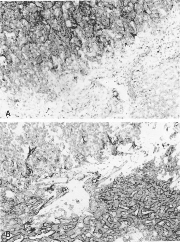 https://cdn.ncbi.nlm.nih.gov/pmc/blobs/b10b/1886895/48556c69fc3b/amjpathol00077-0164-a.jpg