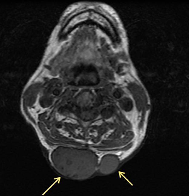 https://cdn.ncbi.nlm.nih.gov/pmc/blobs/b113/8111246/a783e5e706dc/gr7.jpg
