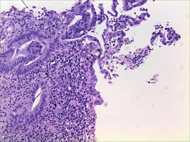 https://cdn.ncbi.nlm.nih.gov/pmc/blobs/b115/12047887/9ebab930bad6/ac9-12-e01682-g005.jpg
