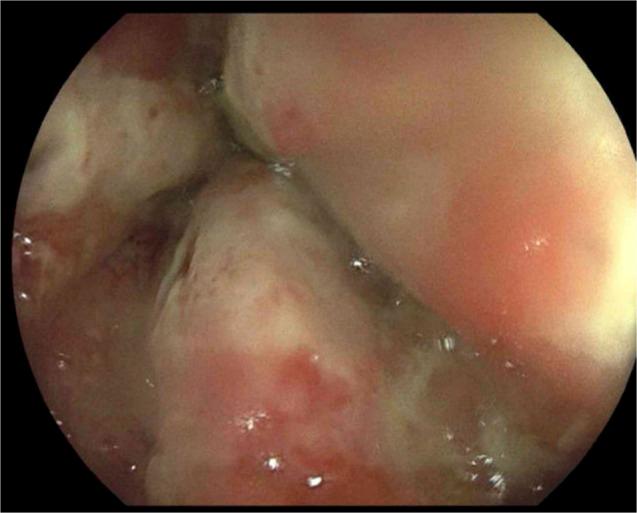 https://cdn.ncbi.nlm.nih.gov/pmc/blobs/b115/12047887/d48a5e5f1277/ac9-12-e01682-g002.jpg