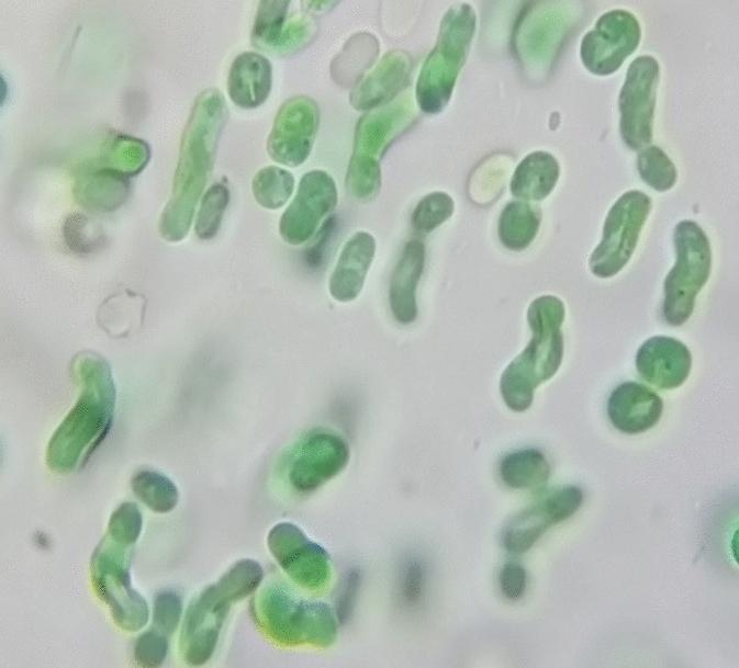 https://cdn.ncbi.nlm.nih.gov/pmc/blobs/b117/11621559/9c6359892bd6/41598_2024_81452_Fig5_HTML.jpg