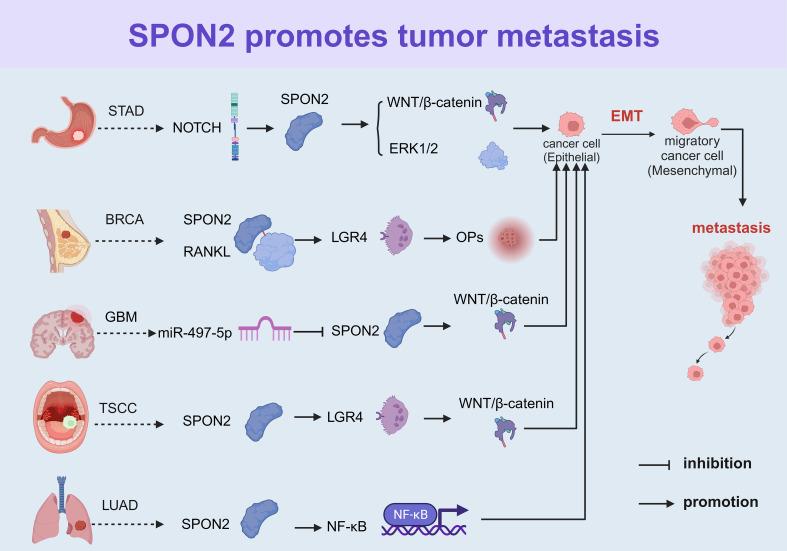 https://cdn.ncbi.nlm.nih.gov/pmc/blobs/b11d/10803442/cbe4d9bd6eb5/fonc-13-1323744-g003.jpg