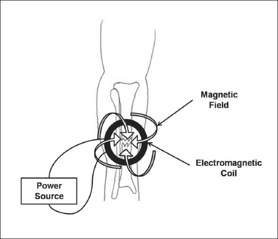 https://cdn.ncbi.nlm.nih.gov/pmc/blobs/b12a/2762253/1652a62441e5/IJO-43-127-g004.jpg