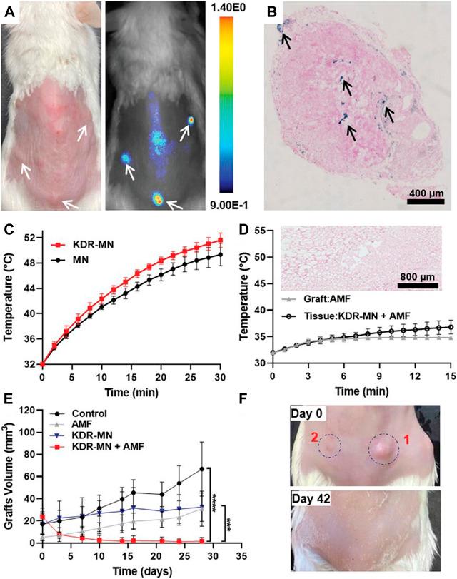 https://cdn.ncbi.nlm.nih.gov/pmc/blobs/b12b/10203239/a097dad68616/fbioe-11-1184155-g004.jpg