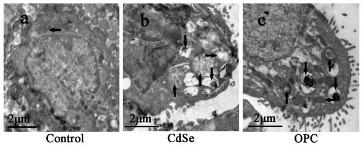 https://cdn.ncbi.nlm.nih.gov/pmc/blobs/b133/9693992/80c86a3e9177/toxics-10-00673-g006.jpg