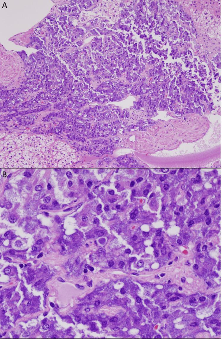 https://cdn.ncbi.nlm.nih.gov/pmc/blobs/b136/10149090/1bb21f1842a4/cureus-0015-00000036963-i02.jpg