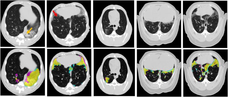 https://cdn.ncbi.nlm.nih.gov/pmc/blobs/b13c/9968618/742a39ebd5f1/gr2_lrg.jpg