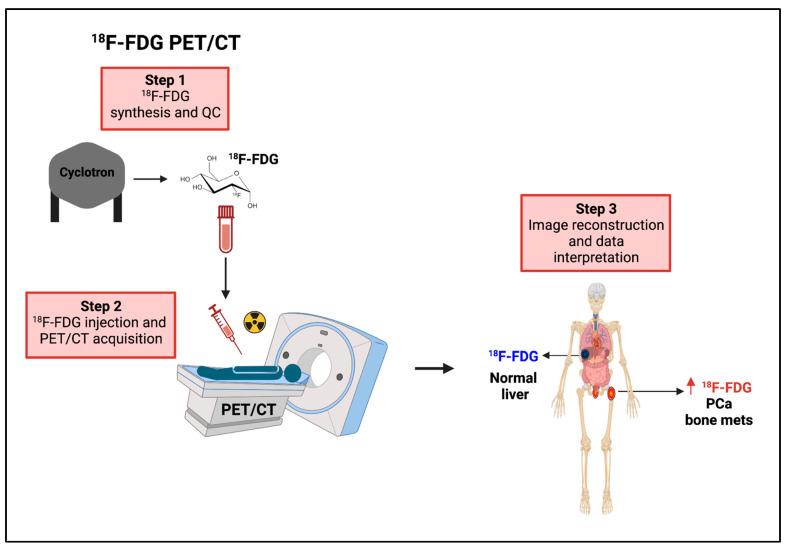 https://cdn.ncbi.nlm.nih.gov/pmc/blobs/b13e/10340474/27a771104acf/cancers-15-03473-g006.jpg