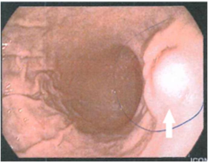 https://cdn.ncbi.nlm.nih.gov/pmc/blobs/b144/9289346/169f45e40f34/gr1.jpg