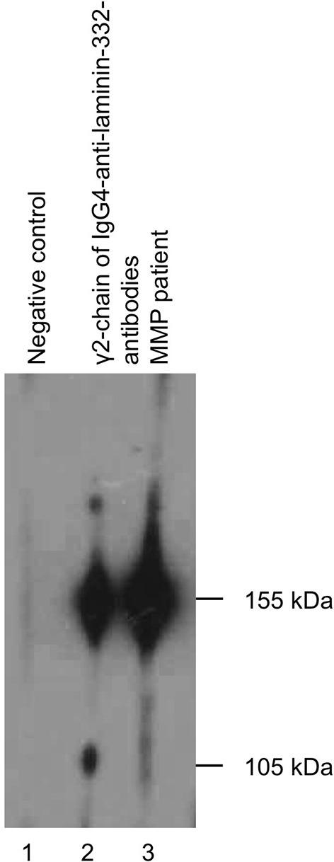 https://cdn.ncbi.nlm.nih.gov/pmc/blobs/b145/6362419/30c7d760f4b9/fmed-06-00008-g0002.jpg