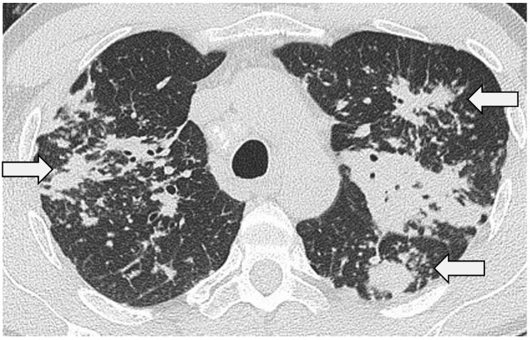 https://cdn.ncbi.nlm.nih.gov/pmc/blobs/b146/10856519/2b3ce2b8b865/jcm-13-00822-g003.jpg