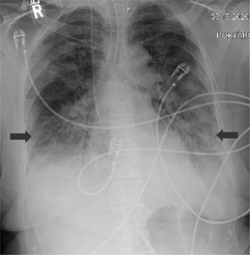 https://cdn.ncbi.nlm.nih.gov/pmc/blobs/b150/7220032/441c04473d59/medi-99-e20207-g001.jpg