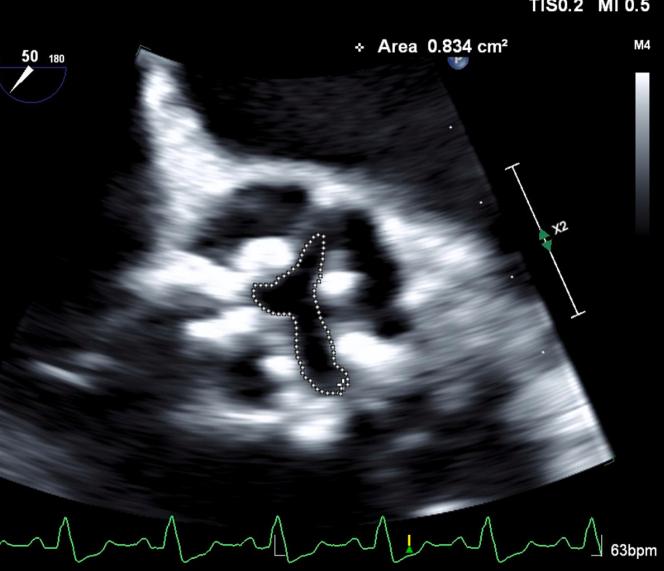 https://cdn.ncbi.nlm.nih.gov/pmc/blobs/b151/12273823/df6cd718aaa3/gr1.jpg