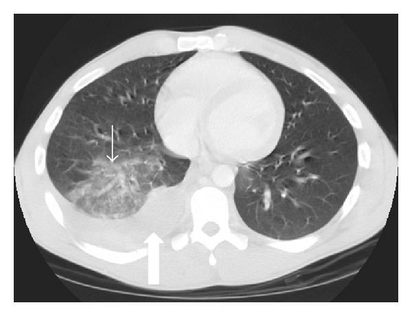 https://cdn.ncbi.nlm.nih.gov/pmc/blobs/b157/4175749/82170067749b/RRP2014-864369.002.jpg