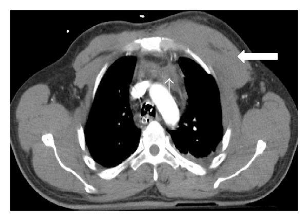 https://cdn.ncbi.nlm.nih.gov/pmc/blobs/b157/4175749/ca5d997e1358/RRP2014-864369.005.jpg