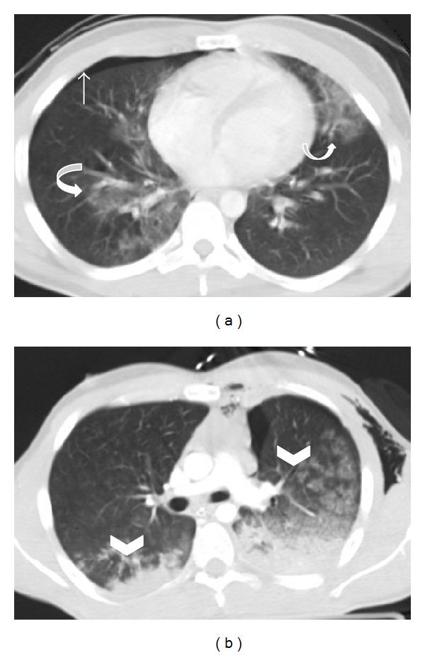 https://cdn.ncbi.nlm.nih.gov/pmc/blobs/b157/4175749/e4bc62265e0d/RRP2014-864369.001.jpg