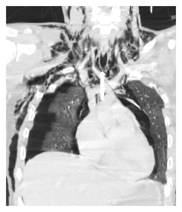 https://cdn.ncbi.nlm.nih.gov/pmc/blobs/b157/4175749/f51566ac1c81/RRP2014-864369.004.jpg