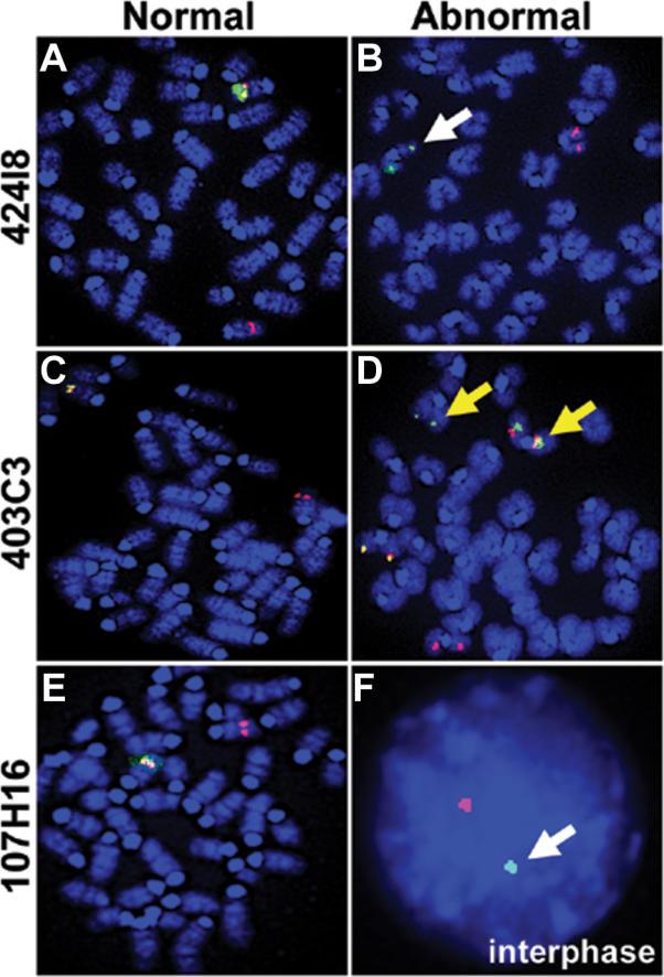https://cdn.ncbi.nlm.nih.gov/pmc/blobs/b15e/1584263/d14b06301b70/pgen.0020156.g008.jpg