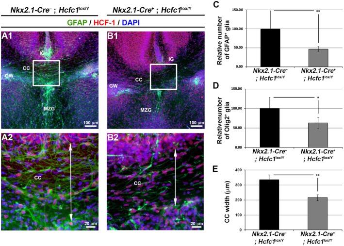 https://cdn.ncbi.nlm.nih.gov/pmc/blobs/b15f/6771735/dde40e7b28c8/DNEU-79-578-g007.jpg
