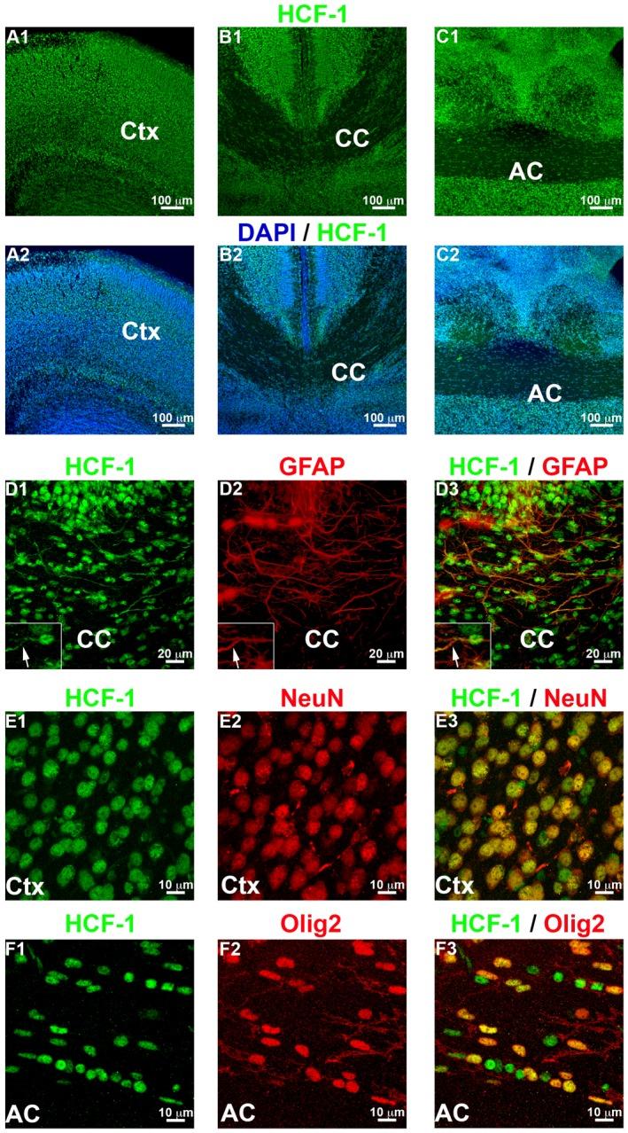 https://cdn.ncbi.nlm.nih.gov/pmc/blobs/b15f/6771735/f87c7a4c3def/DNEU-79-578-g001.jpg