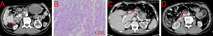 https://cdn.ncbi.nlm.nih.gov/pmc/blobs/b160/11260646/b0bbaf65b033/fimmu-15-1433235-g001.jpg