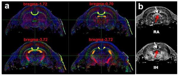 https://cdn.ncbi.nlm.nih.gov/pmc/blobs/b171/5509485/fb6ea2b809d2/nihms865697f3.jpg
