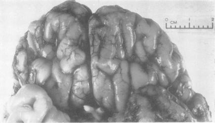 https://cdn.ncbi.nlm.nih.gov/pmc/blobs/b178/1012850/9756bb0acce9/jmedgene00331-0046-a.jpg