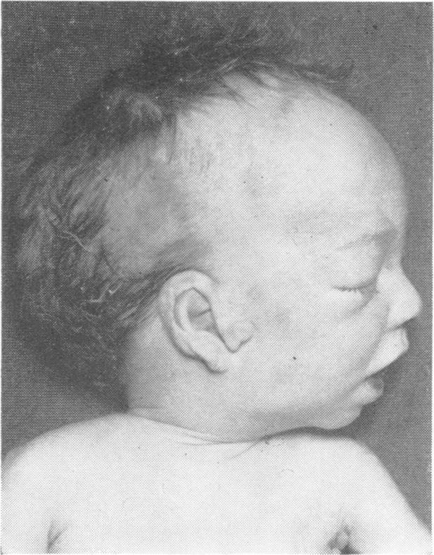 https://cdn.ncbi.nlm.nih.gov/pmc/blobs/b178/1012850/ea639e243b1e/jmedgene00331-0045-a.jpg
