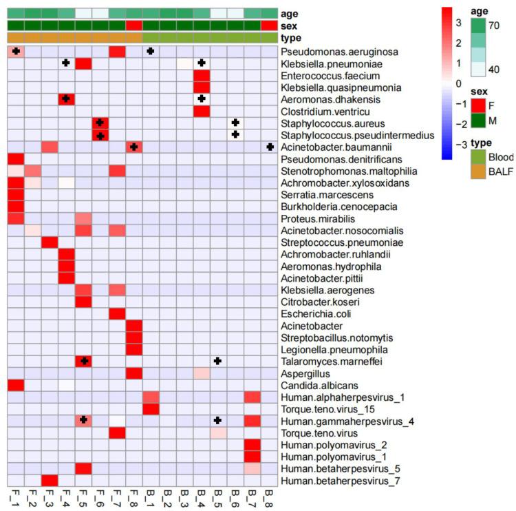 https://cdn.ncbi.nlm.nih.gov/pmc/blobs/b17c/9938705/5af942e793ce/IDR-16-891-g0004.jpg