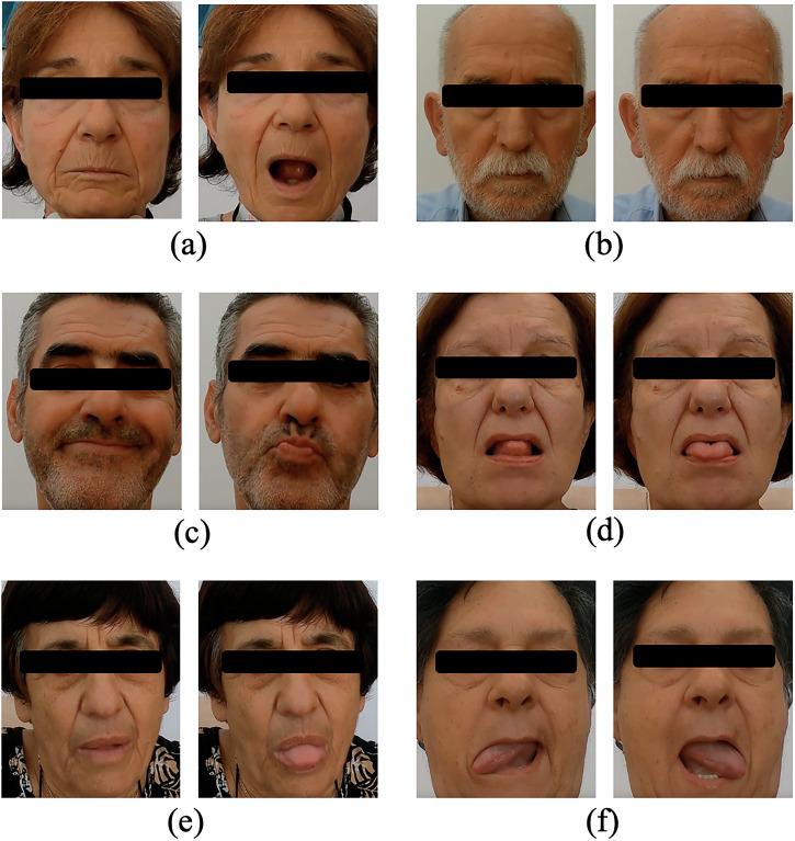 https://cdn.ncbi.nlm.nih.gov/pmc/blobs/b17d/12033283/2125c2d54370/41746_2025_1630_Fig3_HTML.jpg