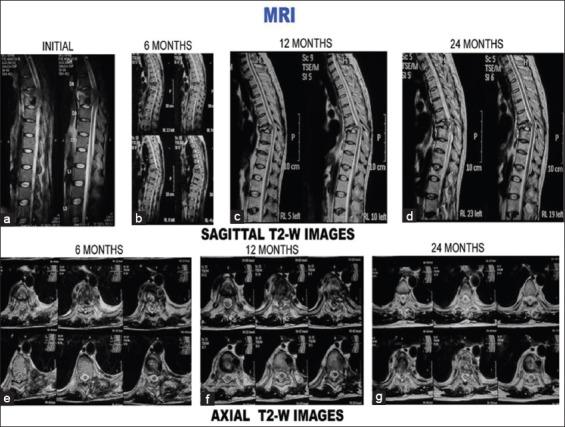 https://cdn.ncbi.nlm.nih.gov/pmc/blobs/b183/5414445/6bb0a7d87641/AMHSR-6-311-g012.jpg