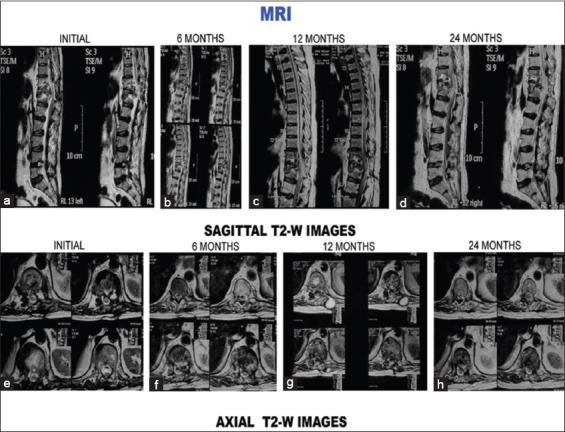 https://cdn.ncbi.nlm.nih.gov/pmc/blobs/b183/5414445/b3634e72a9db/AMHSR-6-311-g009.jpg